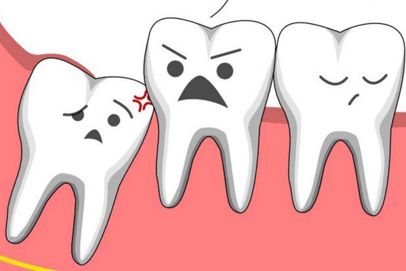 Mộng thấy bị sâu răng chốt số gì?